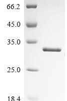 Schizosaccharomyces pombe Histone deacetylase clr6 (clr6), partial Recombinant Protein - BioCrest Sci