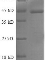 Human Caspase-1 (CASP1), partial Recombinant Protein - BioCrest Sci
