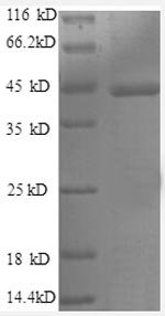 Human Caspase-1 (CASP1), partial Recombinant Protein, Homo sapiens (Human), E.coli, N-terminal GST-tagged, 43.8 kDa, purity >≥ 90% as determined by SDS-PAGE.
