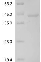 Human C-C motif chemokine 2 (CCL2) Recombinant Protein, C-GST - BioCrest Sci