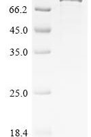 Human Terminal nucleotidyltransferase 5C (TENT5C) Recombinant Protein - BioCrest Sci
