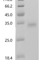 Bovine Insulin-like growth factor 2 (IGF2) Recombinant Protein, C-10His - BioCrest Sci