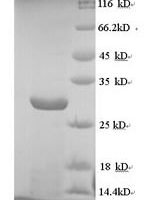 Human cytomegalovirus Envelope glycoprotein L (gL) Recombinant Protein, N-His - BioCrest Sci