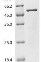 Francisella tularensis subsp. holarctica Chaperone protein DnaK (dnaK), partial Recombinant Protein - BioCrest Sci