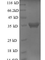 Escherichia coli 50S ribosomal protein L28 (rpmB) Recombinant Protein - BioCrest Sci