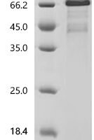Human Disintegrin and metalloproteinase domain-containing protein 9 (ADAM9), partial, Biotinylated Recombinant Protein - BioCrest Sci