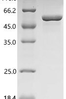 Human Bifunctional phosphoribosylaminoimidazole carboxylase/phosphoribosylaminoimidazole succinocarboxamide synthetase (PAICS) Recombinant Protein - BioCrest Sci