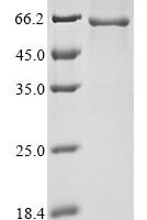 Mouse Desmoglein-3 (Dsg3), partial Recombinant Protein, Tag-Free - BioCrest Sci