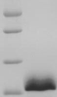 Human Perilipin-1 (PLIN1), partial Recombinant Protein - BioCrest Sci