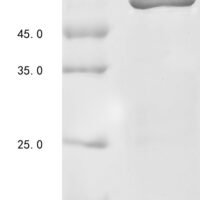 Human Neurofilament light polypeptide (NEFL) Recombinant Protein - BioCrest Sci