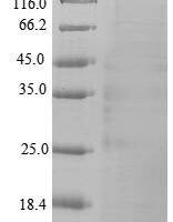 Apomastus schlingeri U1-cyrtautoxin-As1c Recombinant Protein - BioCrest Sci