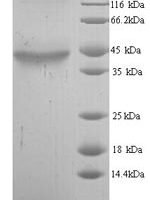 Human Alcohol dehydrogenase class-3 (ADH5) Recombinant Protein, N-His - BioCrest Sci
