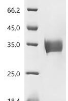 Human Programmed cell death 1 ligand 1 (CD274), partial Recombinant Protein - BioCrest Sci