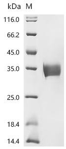 Human Programmed cell death 1 ligand 1 (CD274), partial Recombinant Protein, Homo sapiens (Human), Mammalian cell, C-terminal 10xHis-tagged, 26.9 kDa, purity >≥ 95% as determined by SDS-PAGE.