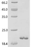 Mouse Glypican-3 (Gpc3) Recombinant Protein - BioCrest Sci
