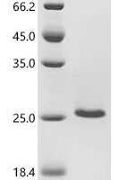 Human papillomavirus 31 Protein E7 (E7) Recombinant Protein - BioCrest Sci