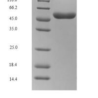 Rabies virus Glycoprotein (G), partial Recombinant Protein, C-9xHis - BioCrest Sci