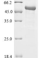 Rat Angiopoietin-1 (Angpt1) Recombinant Protein, C-His, aa 20–497, E.coli - BioCrest Sci