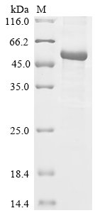 Rat Angiopoietin-1 (Angpt1) Recombinant Protein, C-His, aa 20–497, E.coli, Rattus norvegicus (Rat), E.coli, C-terminal 6xHis-tagged, 56.3 kDa, purity >≥ 85% as determined by SDS-PAGE.