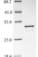 Rat Synapsin-1 (Syn1), partial Recombinant Protein - BioCrest Sci