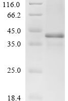 Mouse Dickkopf-related protein 4 (Dkk4) Recombinant Protein - BioCrest Sci