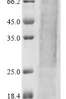 Rat Aldehyde dehydrogenase, mitochondrial (Aldh2) Recombinant Protein - BioCrest Sci