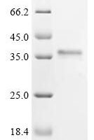 Human 28S ribosomal protein S21, mitochondrial (MRPS21) Recombinant Protein, N-GST, aa 1–87, Yeast - BioCrest Sci