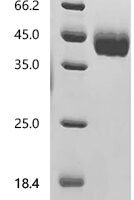 Mouse Pro-neuregulin-1, membrane-bound isoform (Nrg1), partial Recombinant Protein - BioCrest Sci