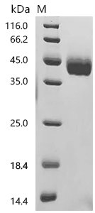 Mouse Pro-neuregulin-1, membrane-bound isoform (Nrg1), partial Recombinant Protein, Mus musculus (Mouse), Mammalian cell, C-terminal 10xHis-tagged, 26.4 kDa, purity >≥ 95% as determined by SDS-PAGE.