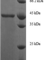 Human Ganglioside GM2 activator (GM2A) Recombinant Protein, N-GST - BioCrest Sci