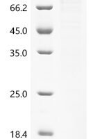 Klebsiella pneumoniae subsp. pneumoniae Penicillin-binding protein 1B, partial Recombinant Protein, N-His/C-His - BioCrest Sci