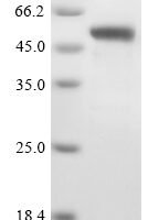 Human Meteorin-like protein (METRNL) Recombinant Protein, N-GST - BioCrest Sci