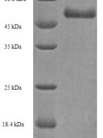 Human Pro-neuregulin-3, membrane-bound isoform (NRG3), partial Recombinant Protein - BioCrest Sci