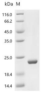 Escherichia coli Large ribosomal subunit protein bL12 (rplL) Recombinant Protein, Escherichia coli (strain ATCC 8739 / DSM 1576 / NBRC 3972 / NCIMB 8545 / WDCM 00012 / Crooks), E.coli, C-terminal 6xHis-tagged, 19.2 kDa, purity >≥ 95% as determined by SDS-PAGE.