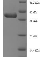Mouse Insulin-like growth factor-binding protein 1 (Igfbp1) Recombinant Protein, N-His-SUMO - BioCrest Sci