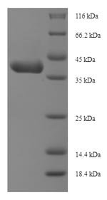 Mouse Insulin-like growth factor-binding protein 1 (Igfbp1) Recombinant Protein, N-His-SUMO, Mus musculus (Mouse), E.coli, N-terminal 6xHis-SUMO-tagged, 42.9 kDa, purity >≥ 90% as determined by SDS-PAGE.