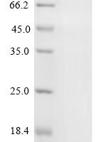 Human Cellular tumor antigen p53 (TP53) (Y220C) Recombinant Protein, C-His - BioCrest Sci