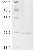 Human Integrin alpha-L (ITGAL), partial Recombinant Protein, C-His - BioCrest Sci