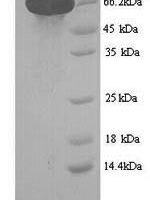 Human Leucine-rich repeat-containing G-protein coupled receptor 5 (LGR5), partial Recombinant Protein, N-His, aa 22–561, Yeast - BioCrest Sci