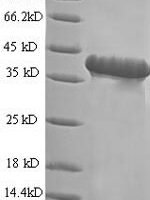 Human Progonadoliberin-2 (GNRH2) Recombinant Protein - BioCrest Sci