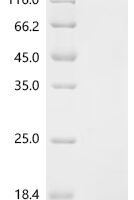 Chicken Fibroblast growth factor 1 (FGF1) Recombinant Protein, Tag-Free - BioCrest Sci