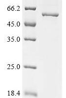 Human T-complex protein 11-like X-linked protein 2 (TCP11X2) Recombinant Protein - BioCrest Sci