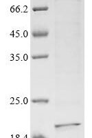 Human Collagen alpha-1 (VIII) chain (COL8A1), partial Recombinant Protein - BioCrest Sci