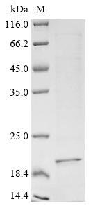 Human Collagen alpha-1 (VIII) chain (COL8A1), partial Recombinant Protein, Homo sapiens (Human), Yeast, C-terminal 6xHis-tagged, 20.0 kDa, purity >≥ 85% as determined by SDS-PAGE.