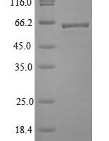 Lassa virus Nucleoprotein (N) Recombinant Protein, Tag-Free - BioCrest Sci
