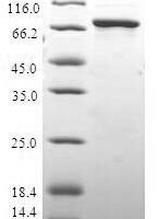 Human HAUS augmin-like complex subunit 4 (HAUS4) Recombinant Protein - BioCrest Sci