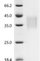 Mouse Hypoxia-inducible factor 1-alpha (Hif1a), partial Recombinant Protein, N-His, aa 380–585, Mammalian cell - BioCrest Sci