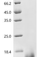Dendroaspis angusticeps Natriuretic peptide DNP Recombinant Protein, C-His - BioCrest Sci