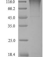 Bovine Serpin A3-5 (SERPINA3-5) Recombinant Protein - BioCrest Sci