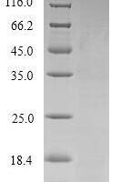 Human Pulmonary surfactant-associated protein B (SFTPB) Recombinant Protein, Tag-Free - BioCrest Sci
